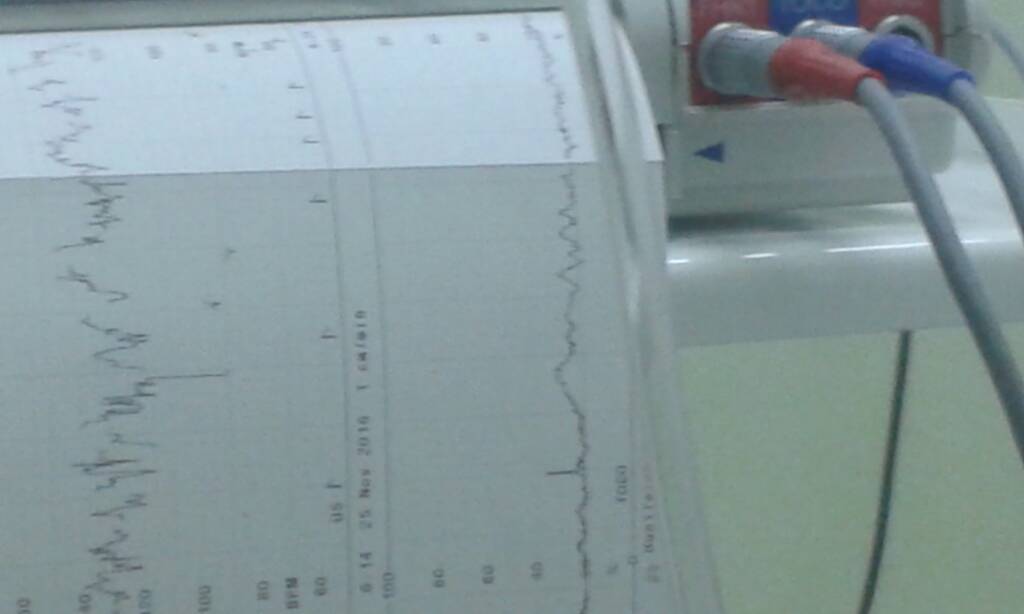 20161125_062651.jpeg