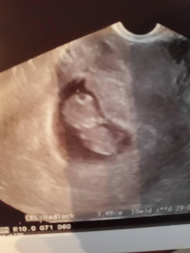 20181204_141103.jpeg 20181204_141103.jpeg