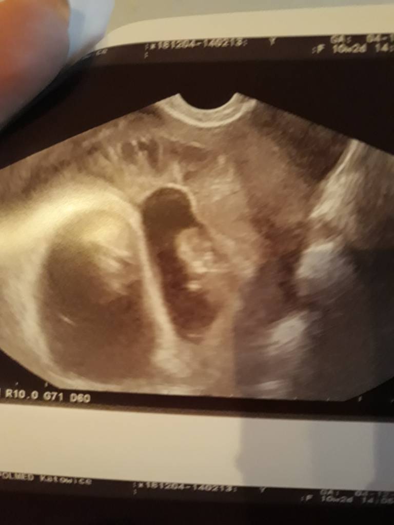 20181204_141118.jpeg 20181204_141118.jpeg