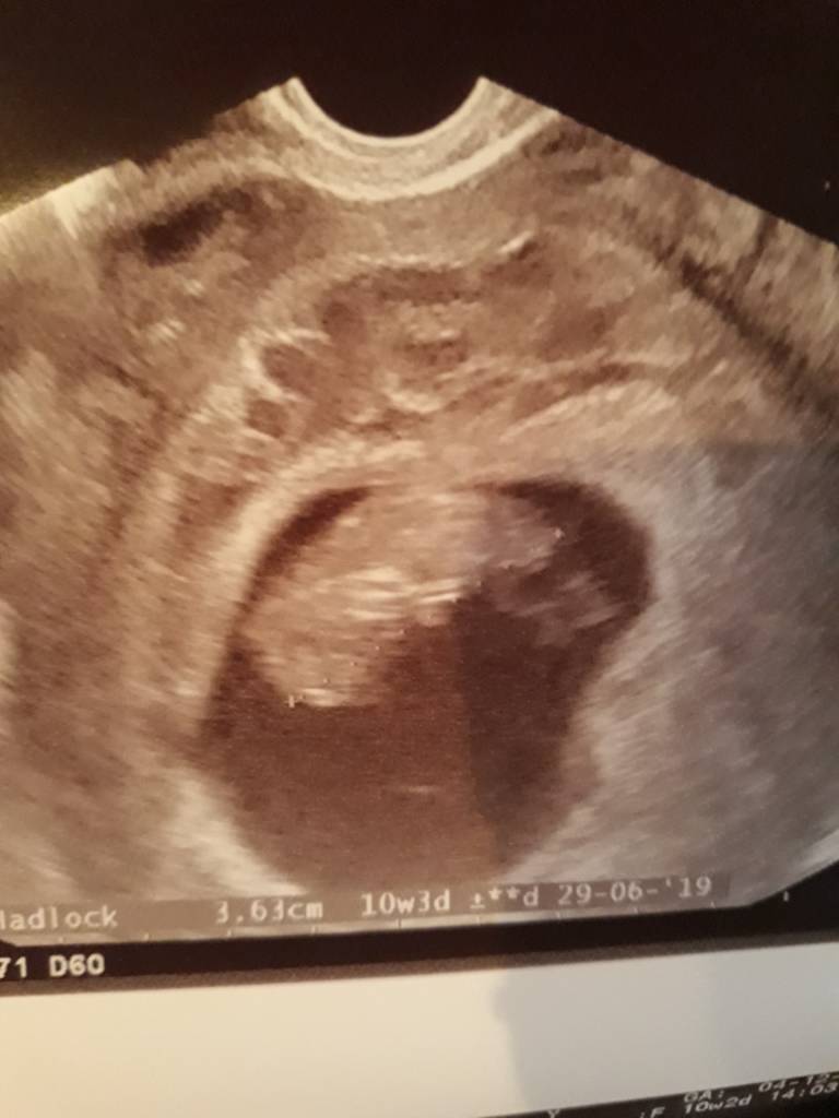 20181204_141130.jpeg 20181204_141130.jpeg