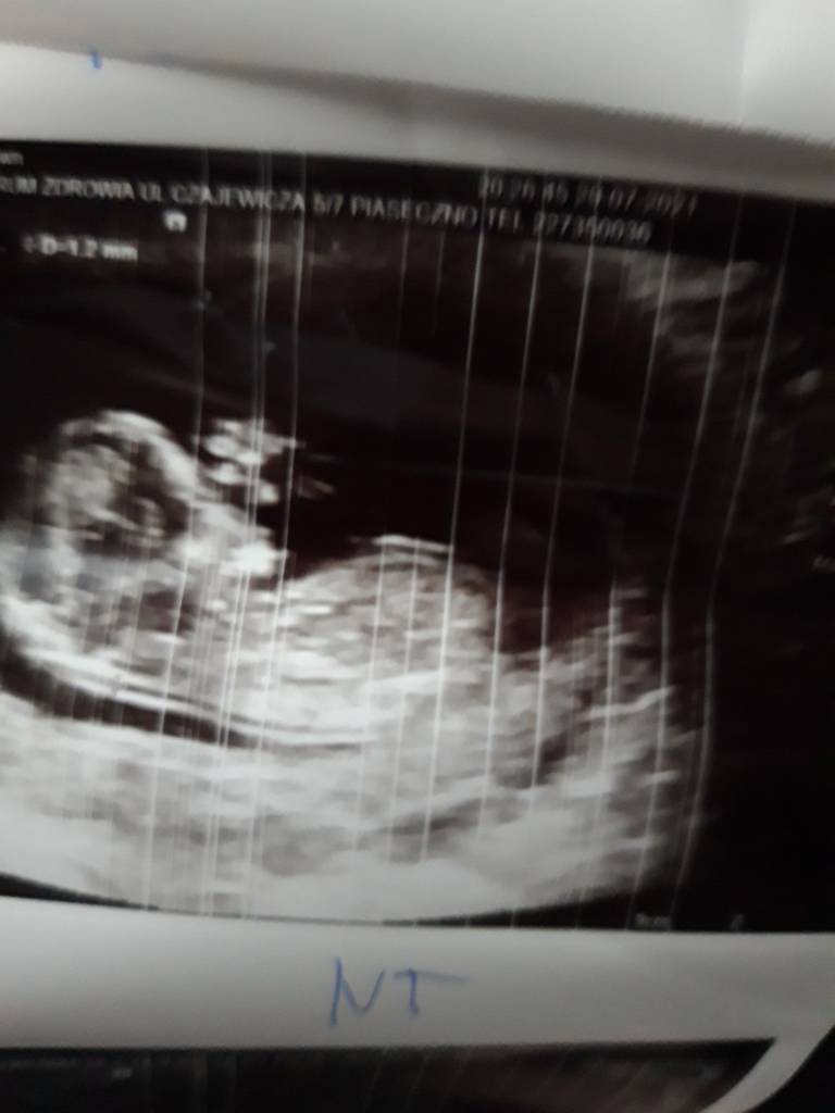 20210729_203519.jpeg
