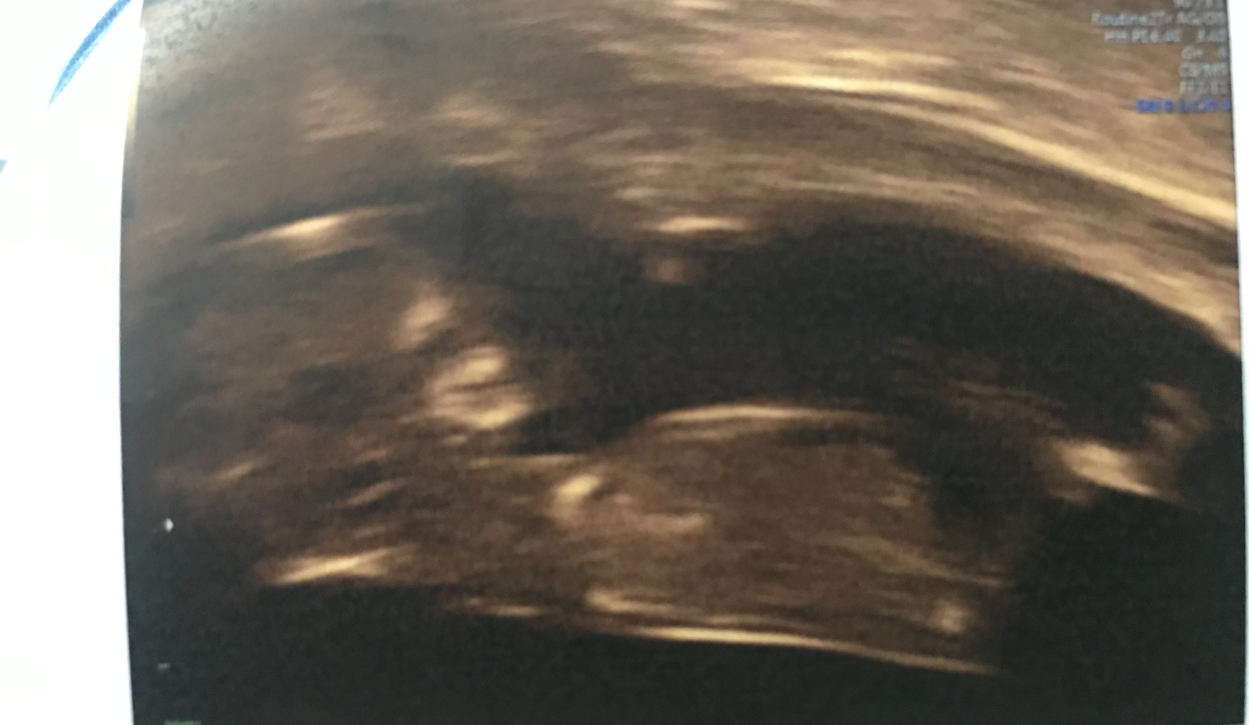 D204971D-1A7F-4F52-B193-7591C4AB96A8.jpeg