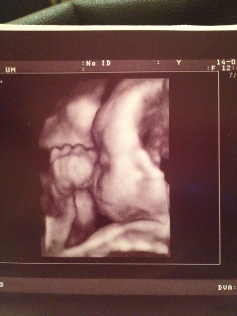ImageUploadedByForum BabyBoom1452777852.825217.jpg