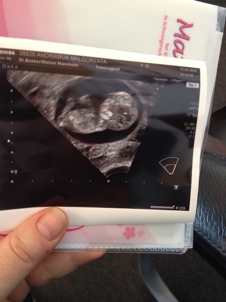 ImageUploadedByForum BabyBoom1456156579.227737.jpg