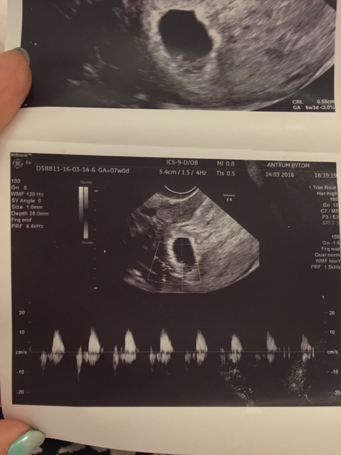 ImageUploadedByForum BabyBoom1457988256.717782.jpg