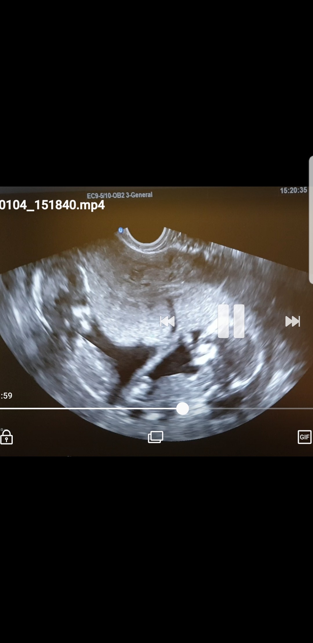 Screenshot_20190104-221236_Gallery.jpg