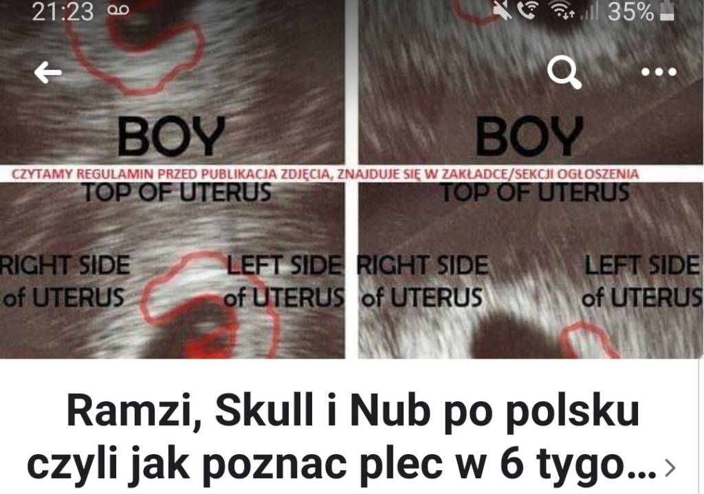 Screenshot_20190901-212340_Facebook.jpeg