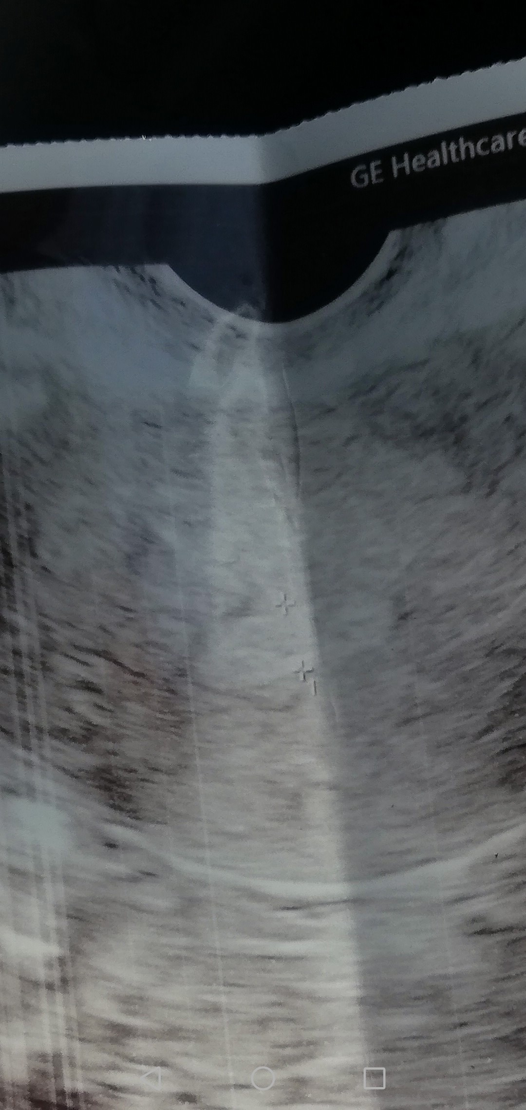 Screenshot_20200507_214008_com.android.gallery3d.jpg