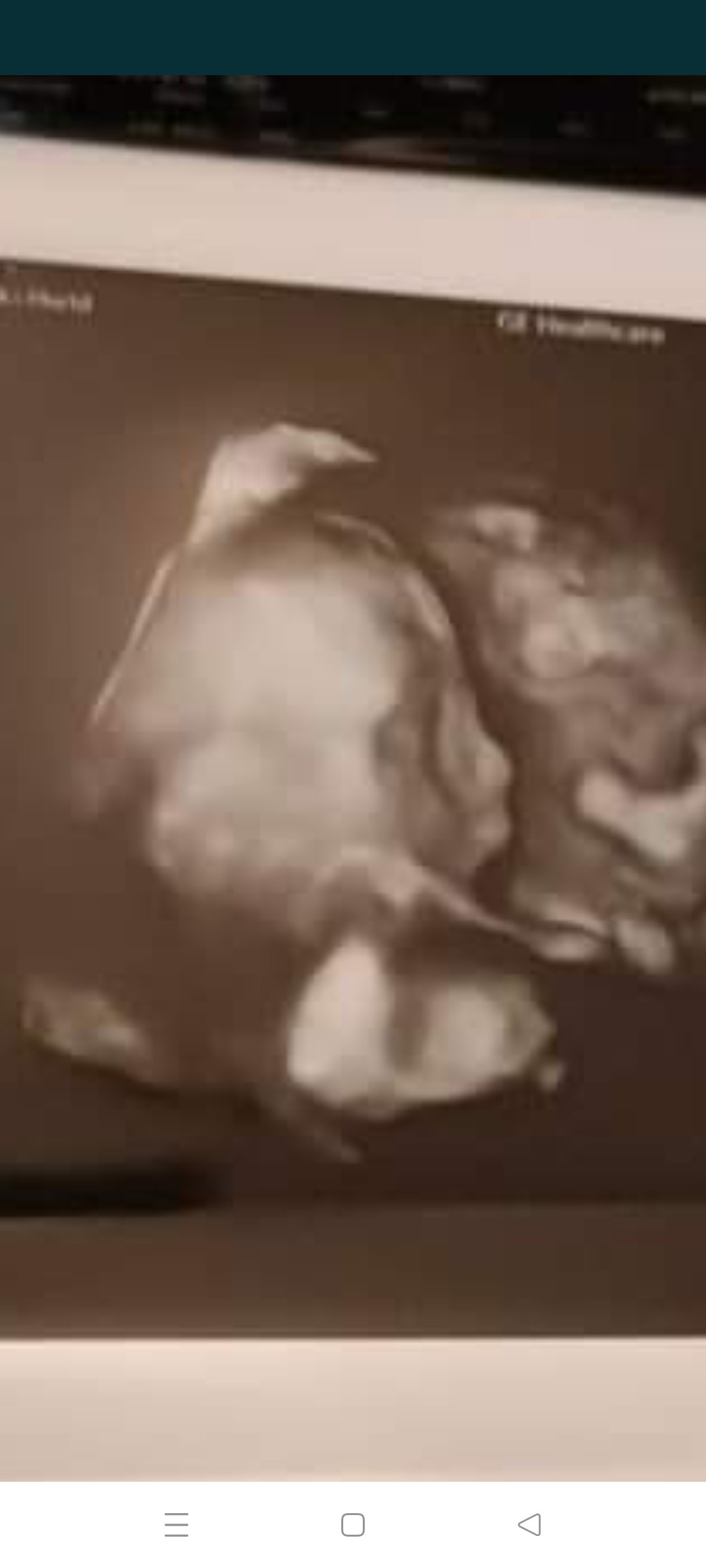 Screenshot_2022-02-08-17-38-59-82_40deb401b9ffe8e1df2f1cc5ba480b12.jpg