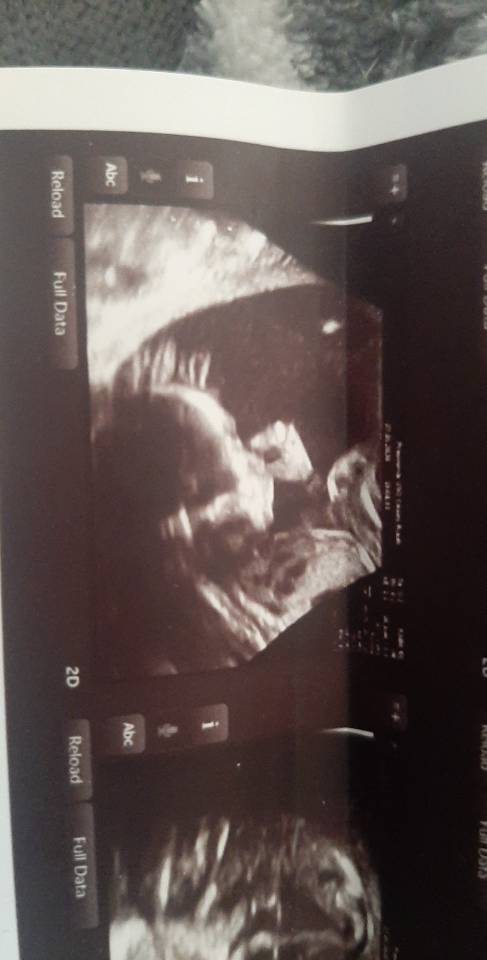 USER_SCOPED_TEMP_DATA_MSGR_PHOTO_FOR_UPLOAD_1590602034164_6671468474307580216~2.jpeg