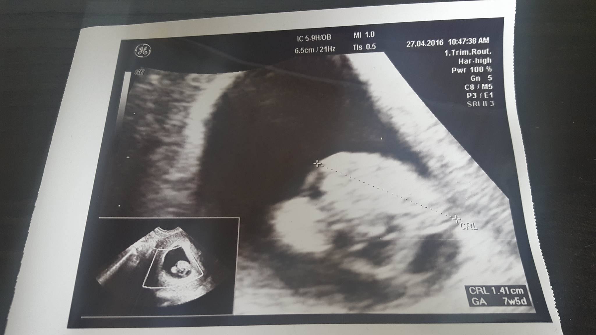 13112446_1012621822157306_569205565_o