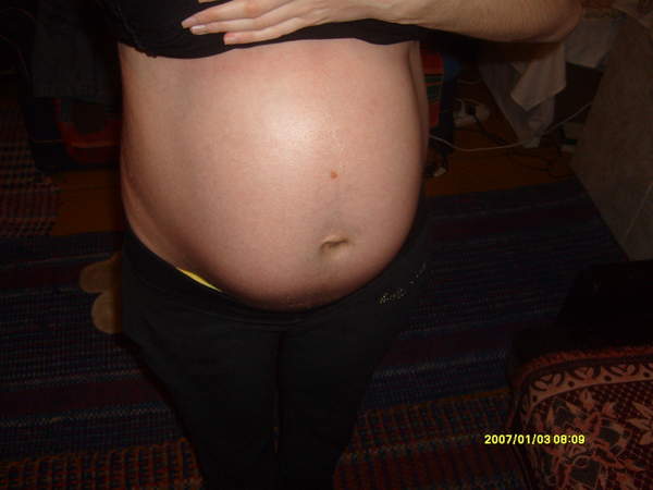 32 tydz ciąży