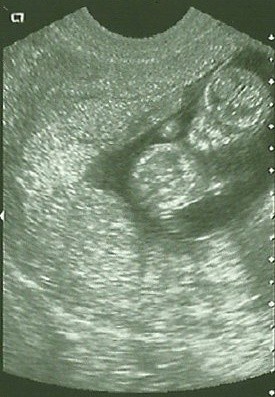 Kosmita ;)
[11t5dc]