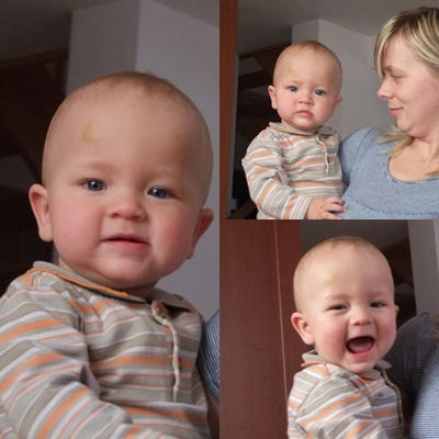 Misio i mały guzek:)