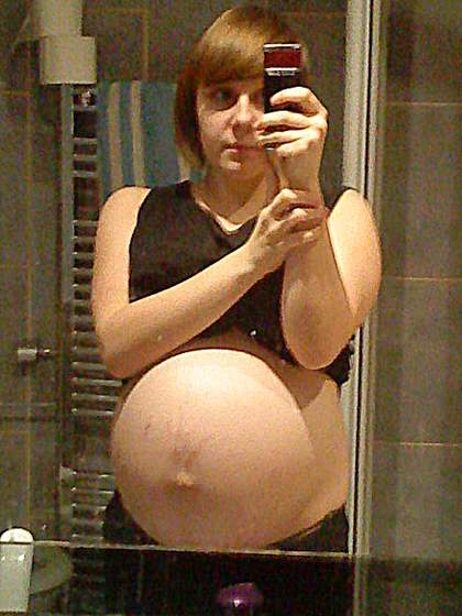 widac ochydne rozstepy ;//