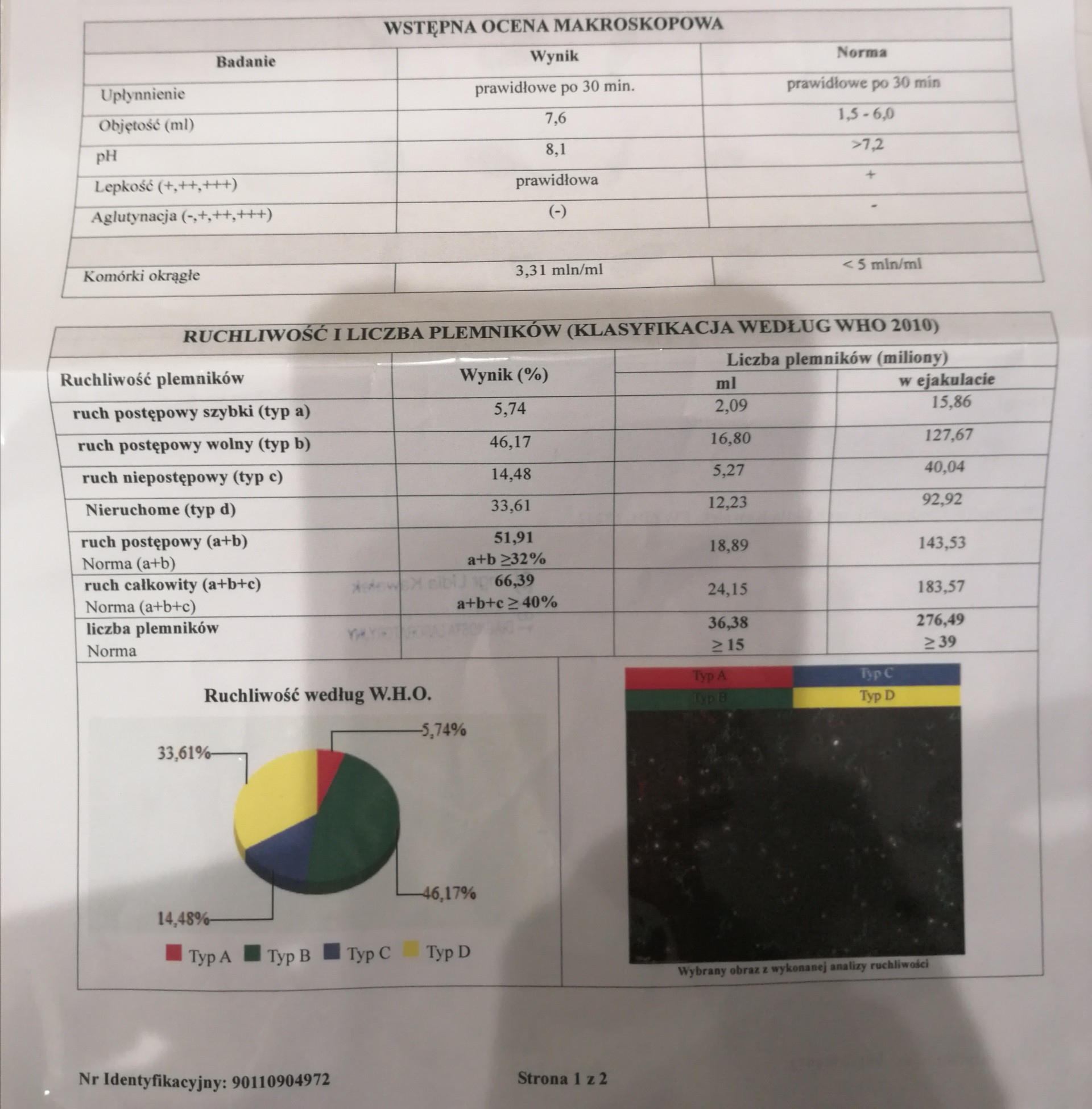 Wyniki badania nasienia
