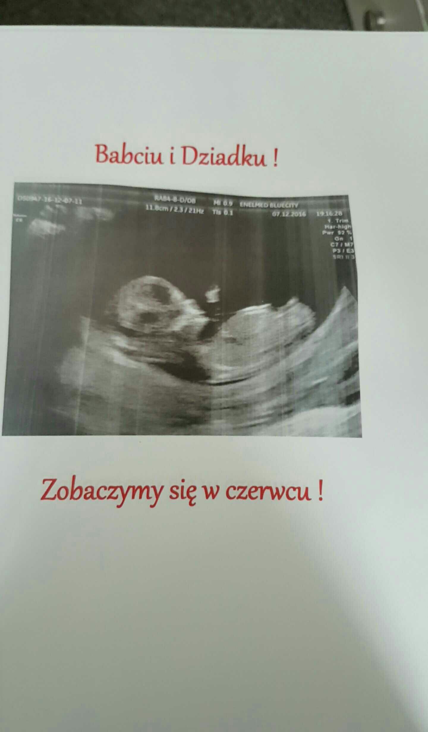 1481196451-1d1mld.jpeg