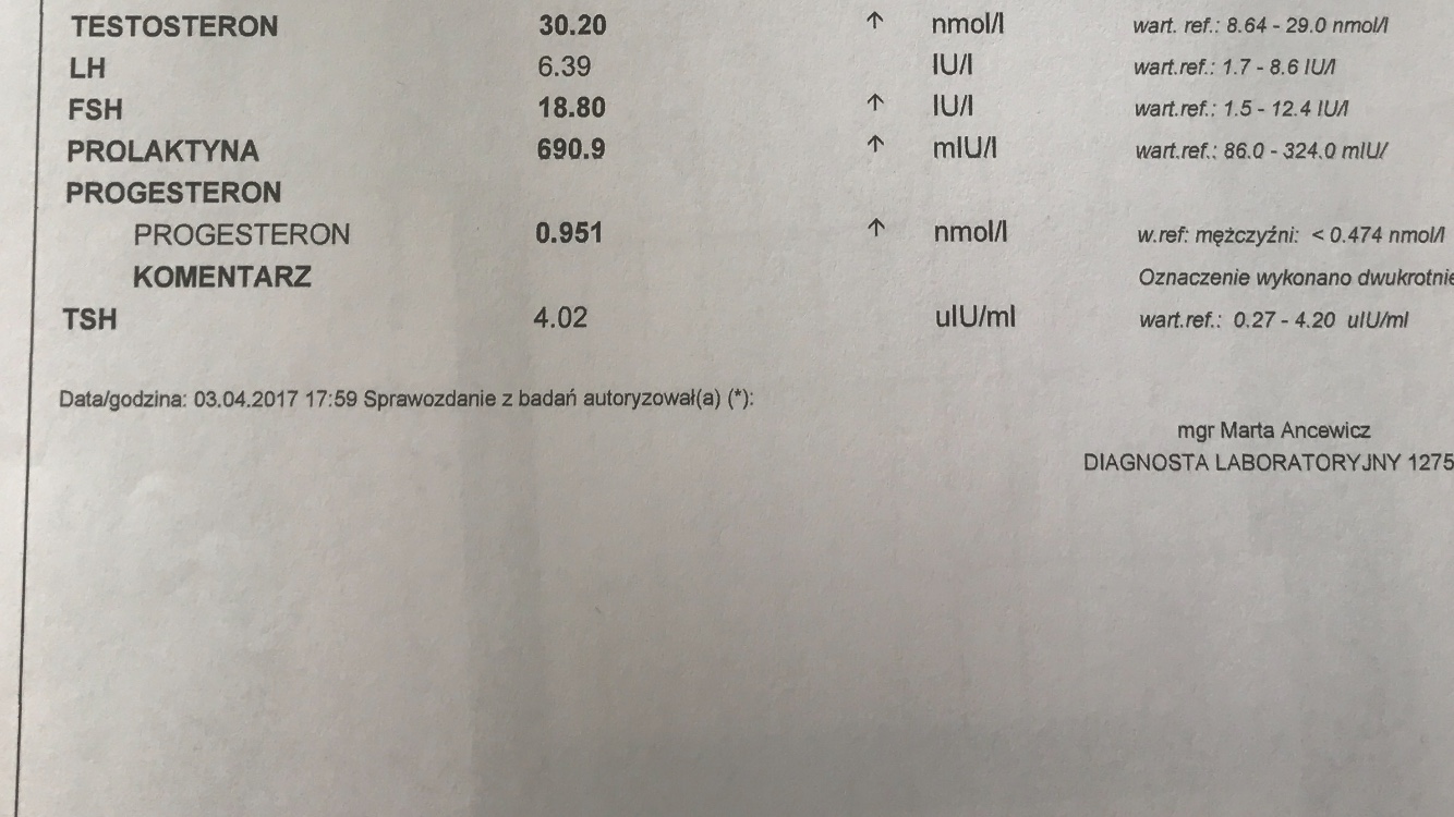 1493888295-aaaaaa.jpeg