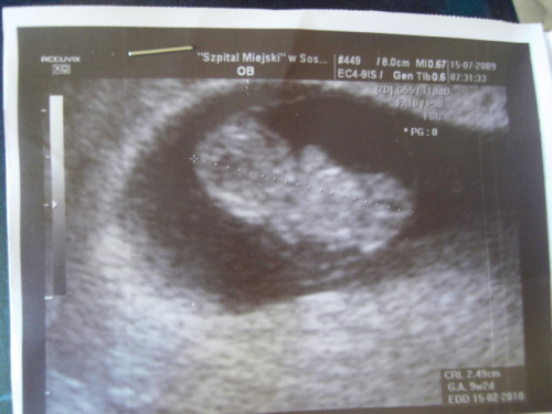 ea802074873d5206med.jpg