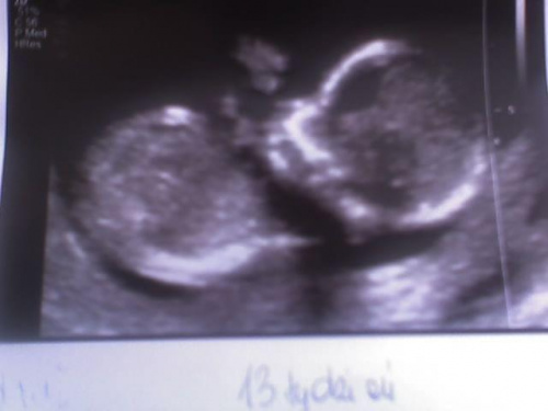 deb7d481acbc3826med.jpg