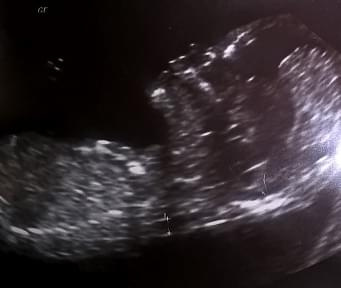 563481e9c5e48723med.jpg