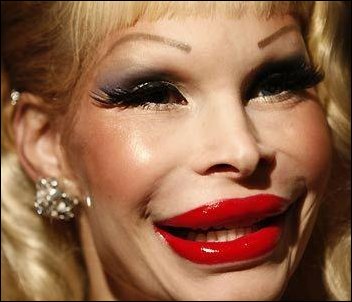 usta-botox-11.jpg