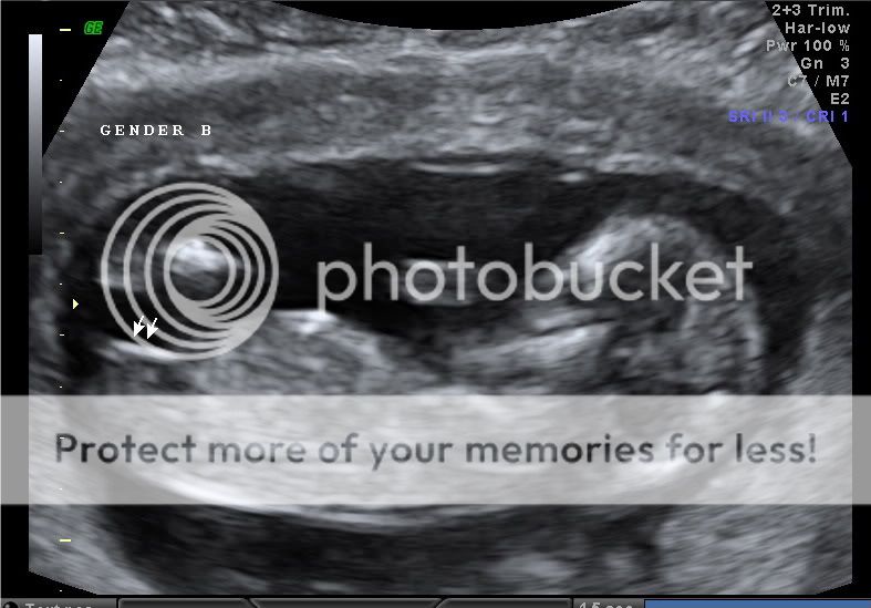 BABY_44.jpg
