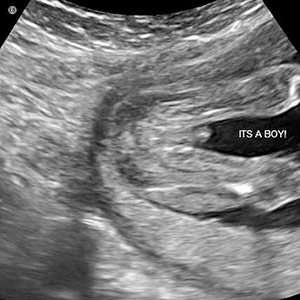 ss_week18_Boy_ultrasound.jpg